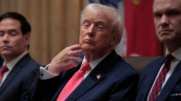 Trump says he got a CT scan instead of an MRI