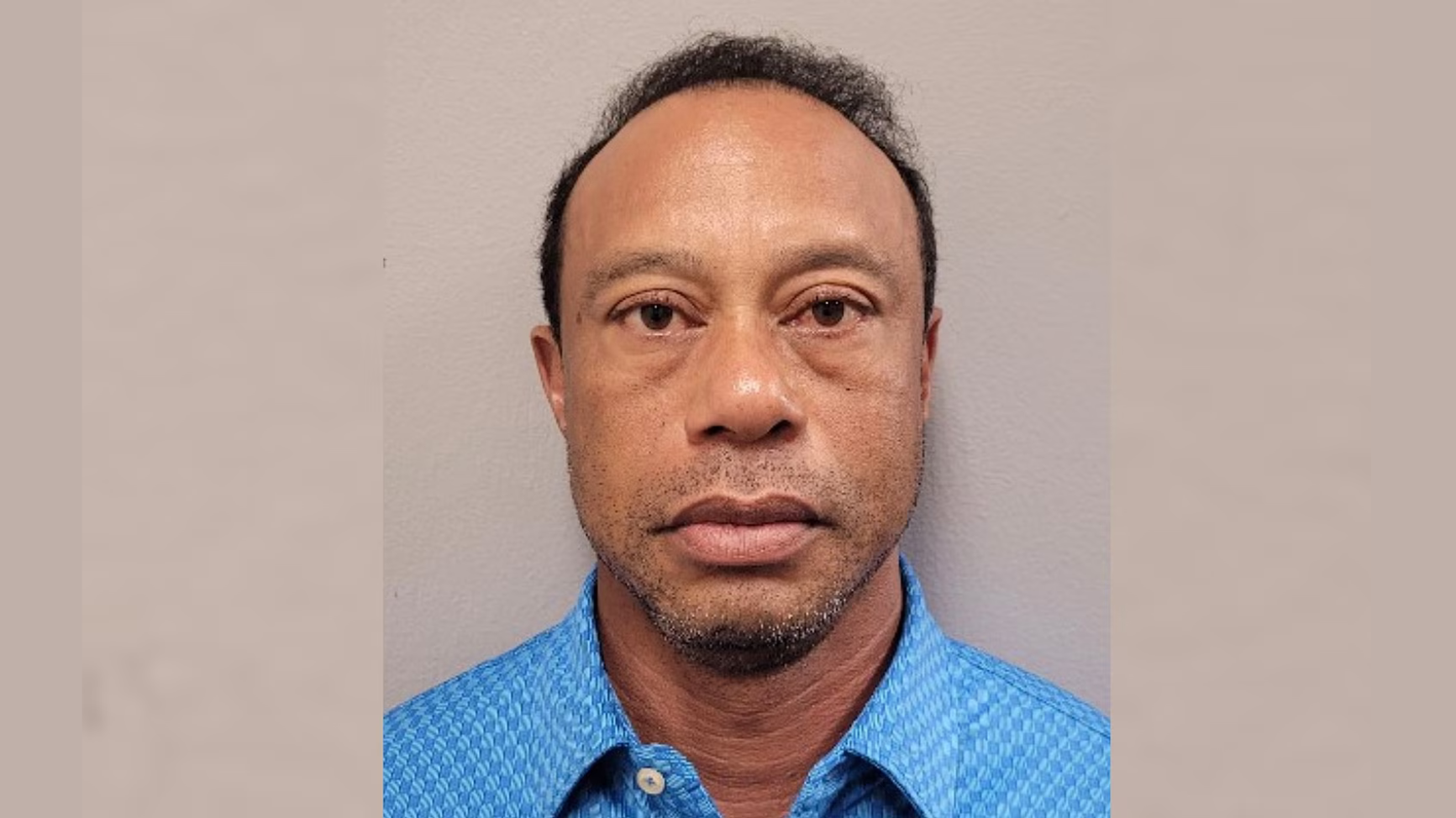 Tiger Woods had ‘bloodshot and glassy’ eyes, ‘extremely dilated’ pupils after car crash: Court documents